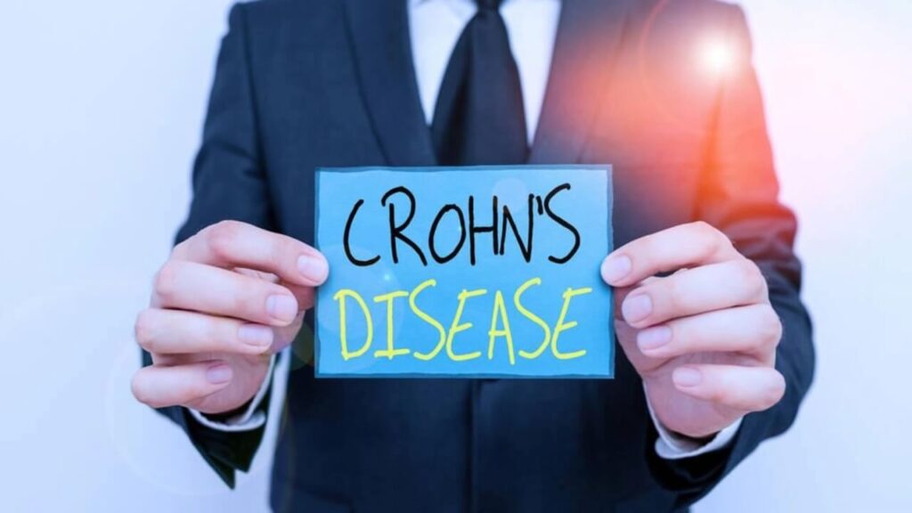 Crohn's Disease